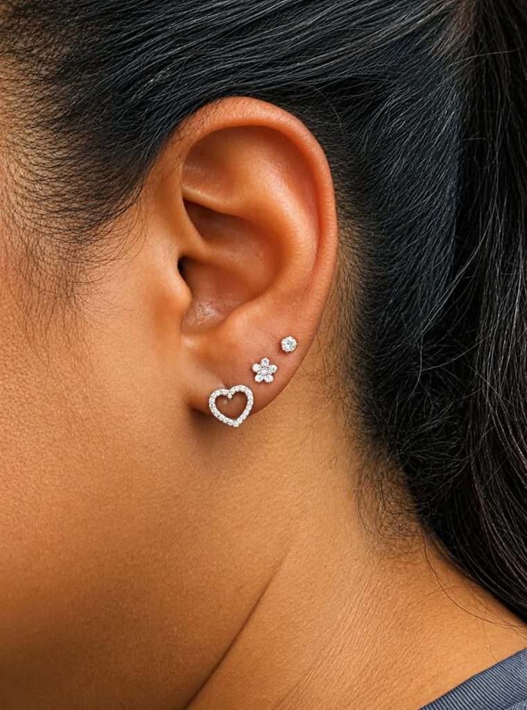 Lobes